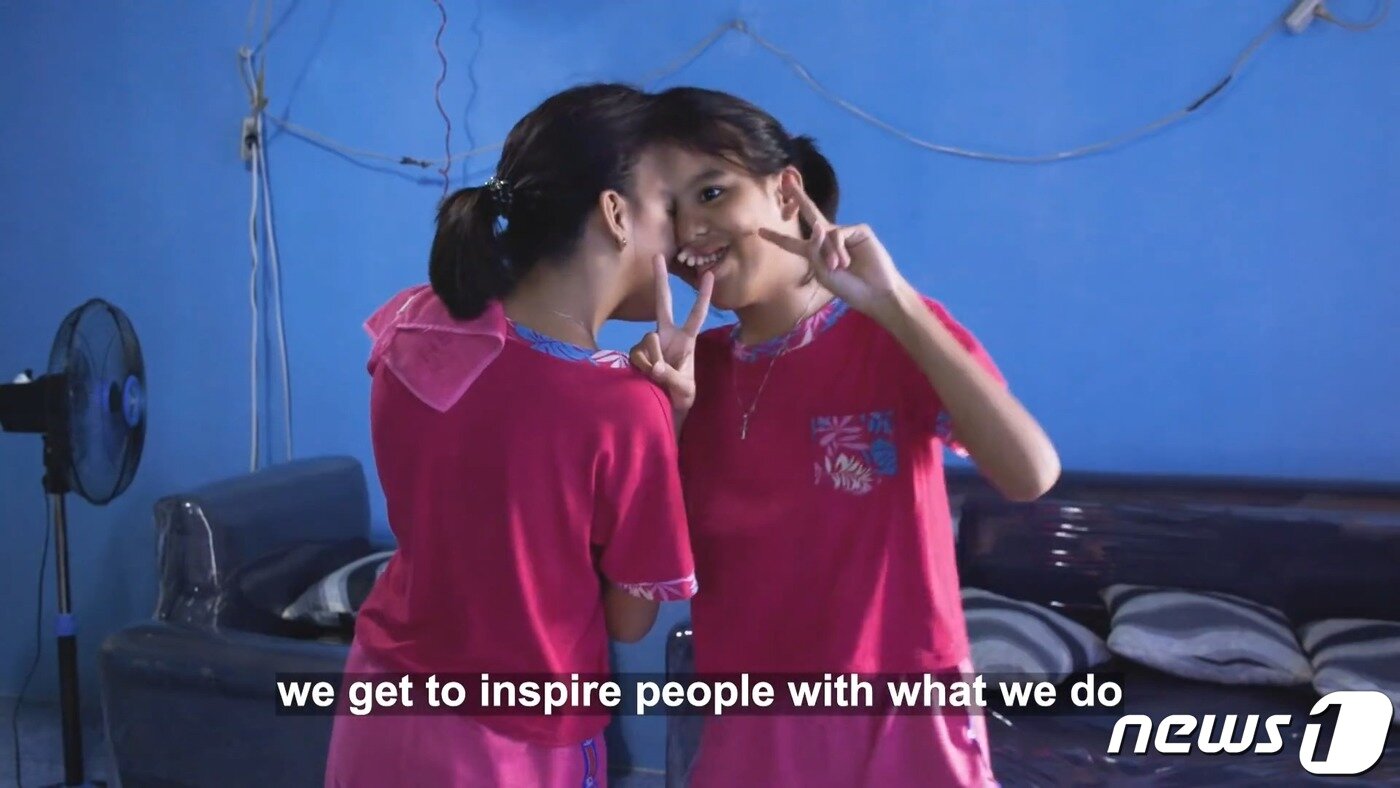 본문 이미지 - <strong>필리핀 샴쌍둥이 자매 '조이와 조이스'</strong>ⓒ News1 이승아 기자