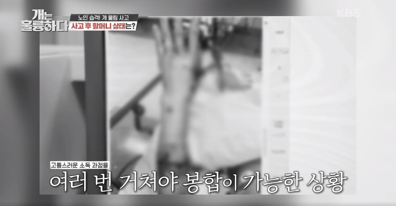 본문 이미지 - 사진 '개는 훌륭하다' 방송 갈무리 ⓒ 뉴스1