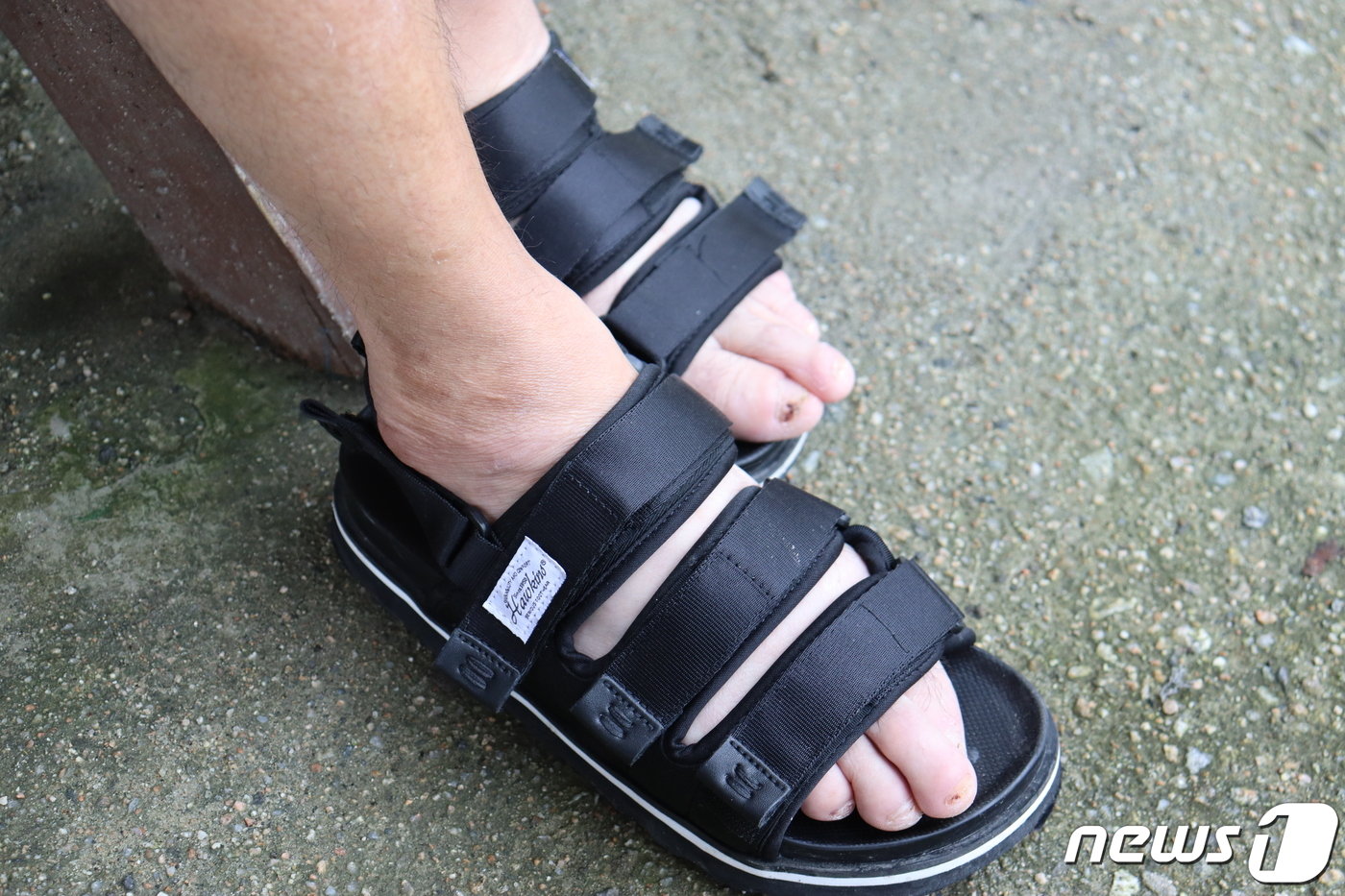 본문 이미지 - 백지혜 사회복자사가 사준 샌들을 신은 왕무형씨의 발. 무형씨는 백 사회복지사가 샌들을 사준 이야기를 하자 인터뷰 중 처음으로 웃었다. 무형씨의 손과 발 얼굴 곳곳에는 상처가 있었다. 동료 장애인들이 물거나 긁어 생긴 상처도 있었지만 최근 건강이 안 좋아지고 걷는 것이 힘들어 지면서 넘어져 생긴 상처가 많았다.  2021.8.26/뉴스1 ⓒ News1 박동해 기자