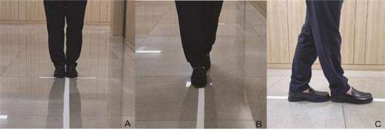 발잇기 일자보행(Tandem gait) 진단법(경희대의료원 제공) © 뉴스1