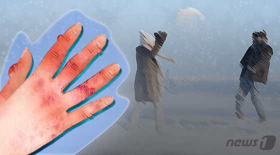 겨울철 '손발 저림' 가볍게 넘기면 안 된다…조직 괴사 위험도