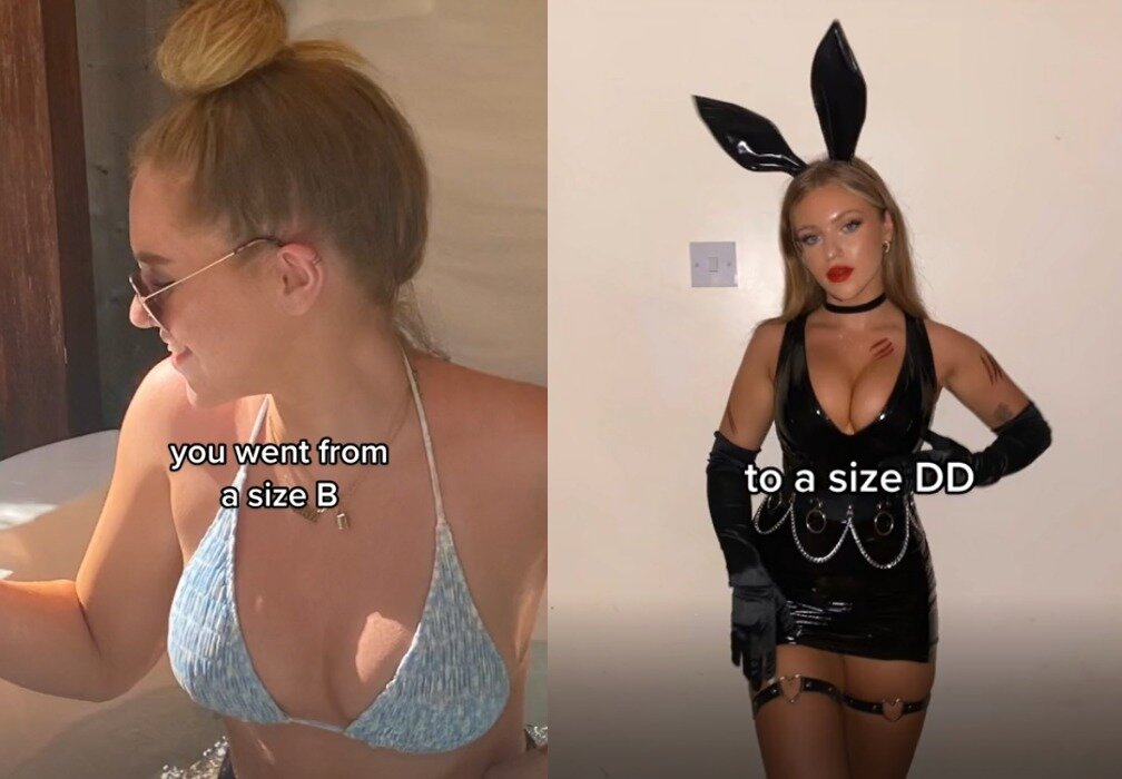 본문 이미지 - 다르시는 피임약 복용 전후로 달라진 가슴 크기를 보여줬다. (틱톡 갈무리) ⓒ 뉴스1