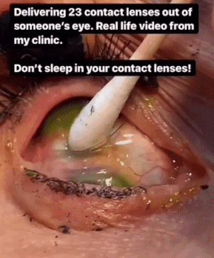 본문 이미지 - (인스타그램)