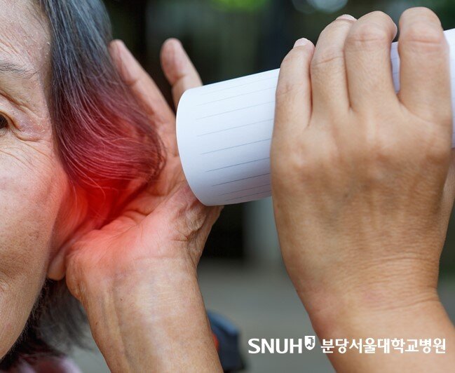 본문 이미지 - (분당서울대병원 제공)