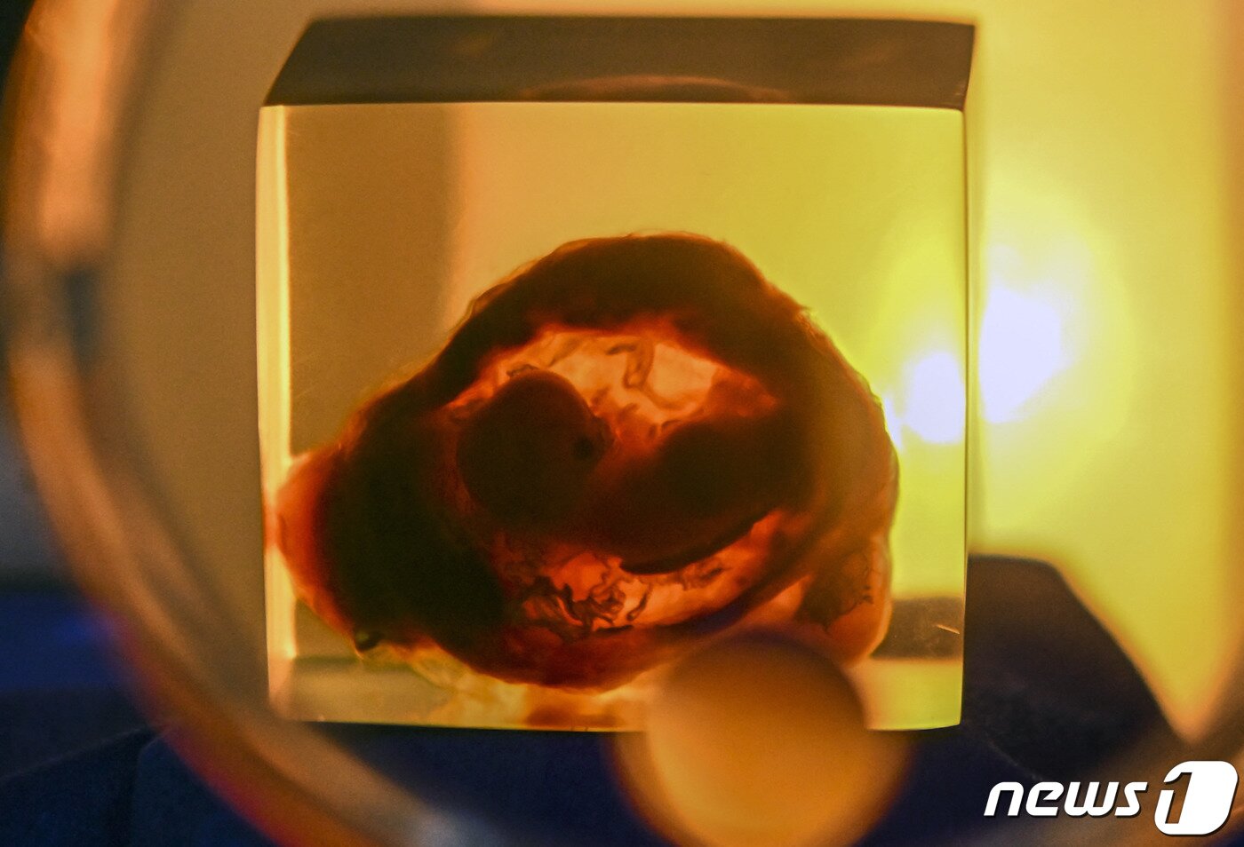 본문 이미지 - 콜롬비아 보고타 인간박물관에서 유리 용기 안에 담긴 태아 모습이 전시되고 있다. 보고타 인간박물관은 과학적 관심이자 공포의 대상인 해부학 관련 전시물을 보유하고 있다. &#40;사진은 기사 내용과 무관함&#41; / 뉴스1 ⓒ News12022. 11. 25. ⓒ AFP=뉴스1 ⓒ News1 최서윤 기자