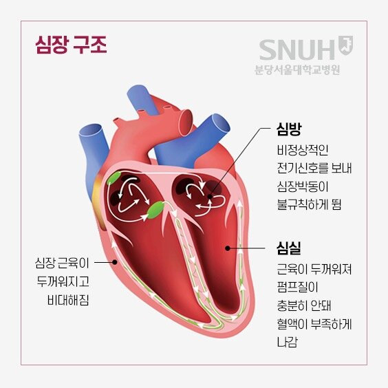 본문 이미지 - (분당서울대병원 제공)
