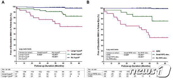 본문 이미지 - A그림/ 안저 검사에서 탈색소 병변 크기에 따라, 습성 황반변성으로의 진행 위험도가 통계학적으로 유의하게 높았다. B그림/ 망막색소상피 (Retinal pigment epithelium) 올라감 (elevation) 소견의 크기에 따라, 습성 황반변성으로의 진행 위험도가 통계학적으로 유의하게 높았다. ⓒ 뉴스1