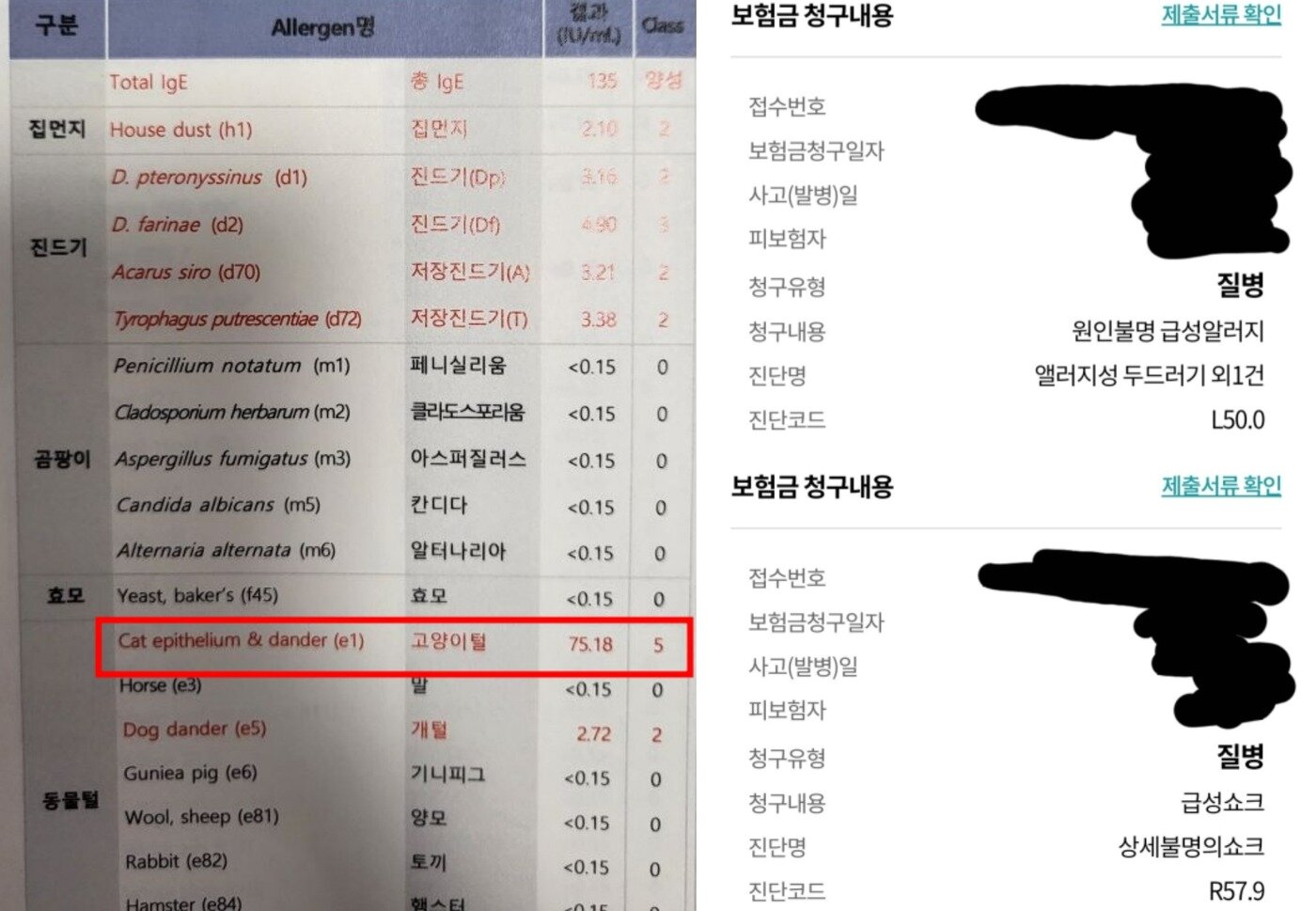 본문 이미지 - A씨가 공개한 혈액 마스트(MAST) 검사 결과(왼쪽), 알레르기 관련 보험금 청구 내역. (온라인 커뮤니티 갈무리) ⓒ 뉴스1