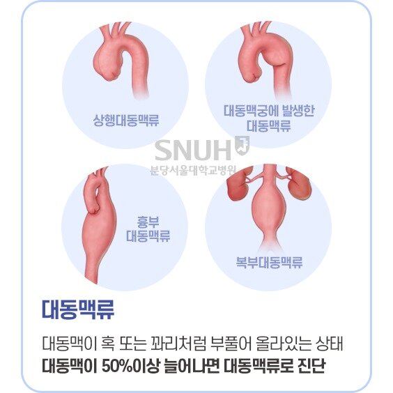 본문 이미지 - (분당서울대병원 제공)ⓒ 뉴스1