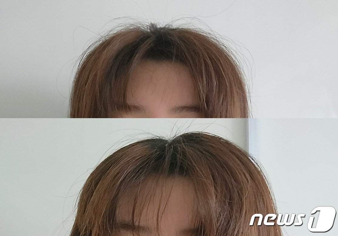 본문 이미지 - 머리를 감고 단순 자연 건조한 상태(위)에서 약 1분가량 플라이어웨이 노즐을 사용해 잔머리를 가라앉힌 모습(아래) ⓒ 뉴스1 노우리 기자