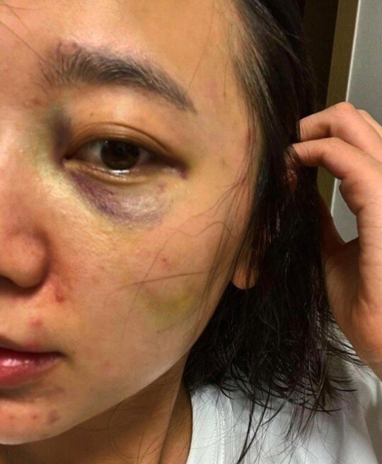 본문 이미지 - 사진=서사랑 인스타그램