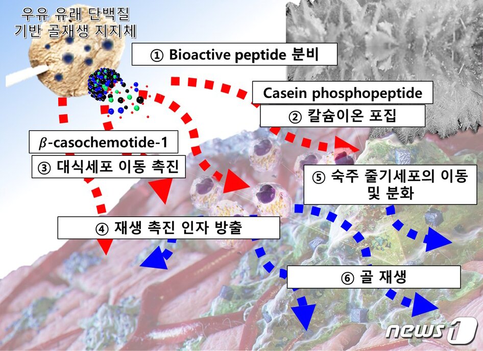 본문 이미지 - 골 재생 유도지지체 모식도.(단국대 제공)