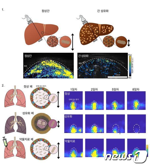 나노 자성-버블을 적용한 비침습적 조직 검사 실험.&#40;IBS 제공&#41;/뉴스1