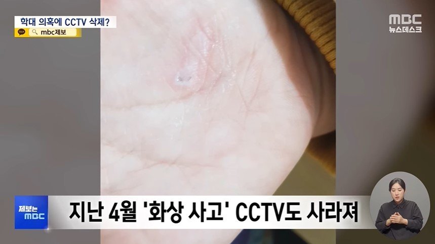 본문 이미지 - (MBC 갈무리)