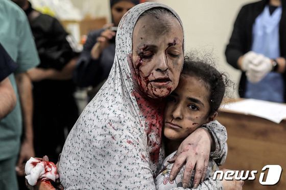 [사진] 피 흘리며 아이 끌어안는 가자지구 여성