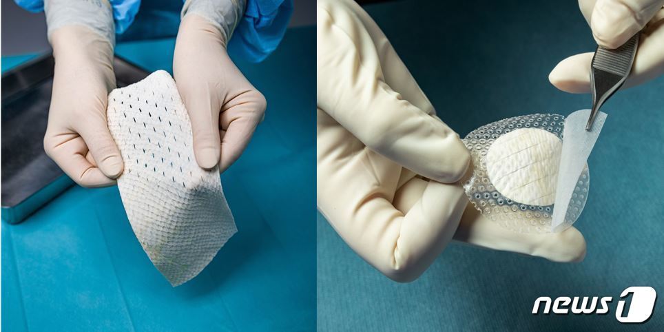 본문 이미지 - 대구 껍질을 이용한 상처치료제&#40;출처:케레시스 누리집 갈무리&#41;