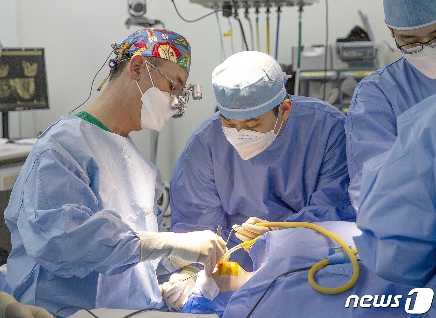 본문 이미지 - 오태석 서울아산병원 성형외과 교수(맨 왼쪽)가 구순구개열 환아에게 잇몸뼈 이식 수술을 하고 있다/(서울아산병원 제공)