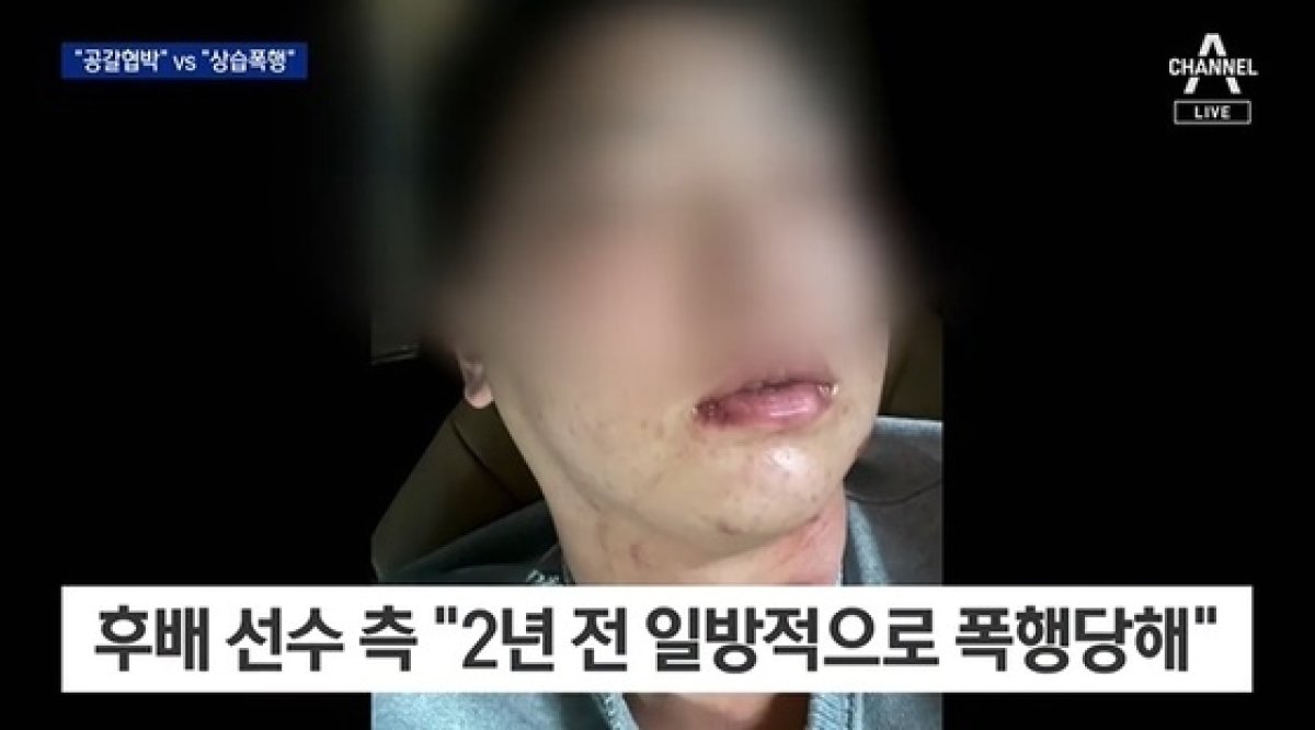 임혜동은 김하성에게 상습 폭행을 당했다며 증거 사진을 공개하기도 했으나, 이는 임혜동이 과거 가정 폭력을 당했을 때 찍은 사진이라는 의혹이 제기됐다. (채널A 갈무리)