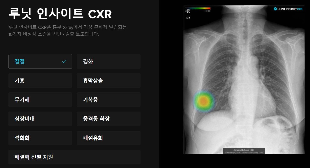 루닛 홈페이지 화면 갈무리