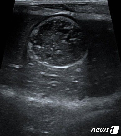 본문 이미지 - 담낭점액종 초기 증상을 보인 강아지 초음파 사진&#40;VIP동물의료센터 성북점 제공&#41; ⓒ 뉴스1