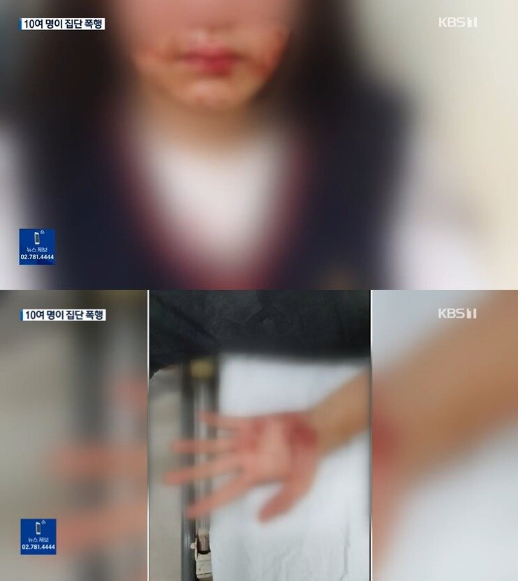 본문 이미지 - (KBS 갈무리)