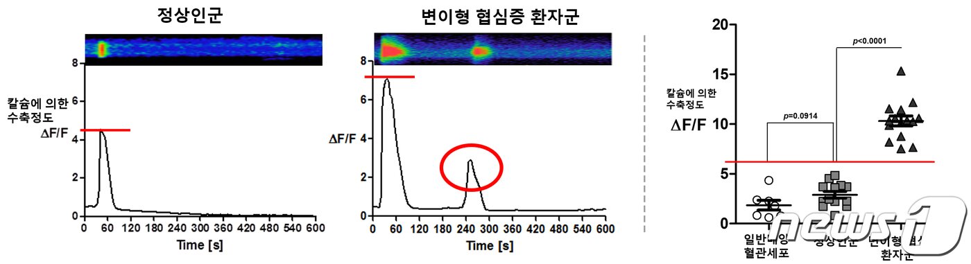 정상인군 및 변이성 협심증 환자군의 칼슘에 의한 수축정도 비교&#40;왼쪽&#41; 및 정량화 결과/서울대학교병원 제공