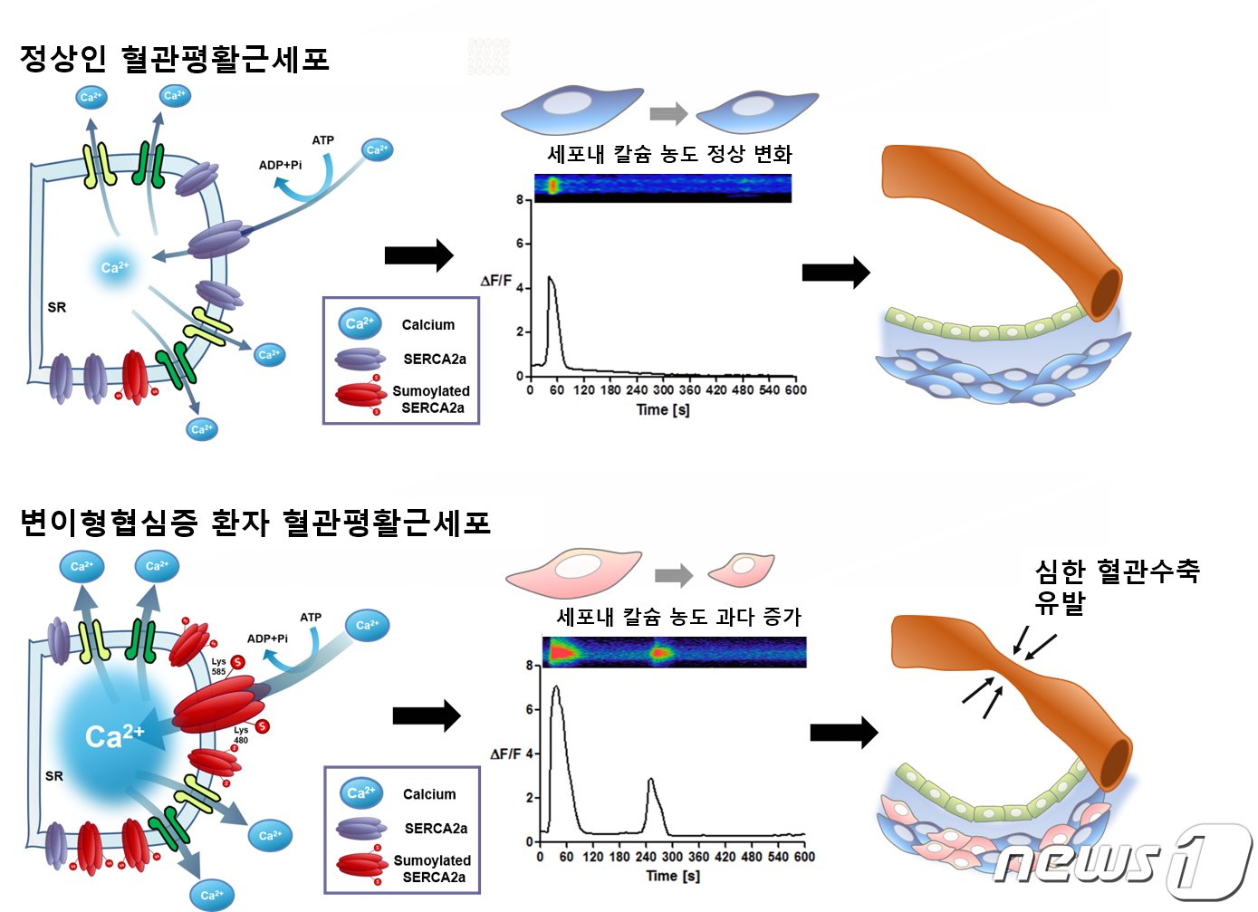 정상인군 및 변이형 협심증 환자군의 칼슘에 의한 수축정도 비교&#40;좌&#41; 및 정량화 결과&#40;우&#41; 칼슘 농도를 정량화하자 정상인군과 환자군을 확실히 구분할 수 있었다./서울대학교병원 제공