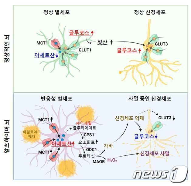 본문 이미지 - 알츠하이머에서 아세트산의 이상 과다흡수를 통해 촉진되는 반응성 별세포화와 이에 의한 신경세포 대사 및 기능 저하 기전. (기초과학연구원 제공) /뉴스1