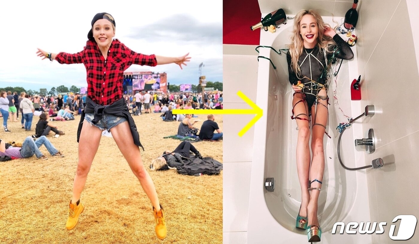 본문 이미지 - 사지연장술을 통해 170㎝에서 184㎝가 된 피셔. (인스타그램)