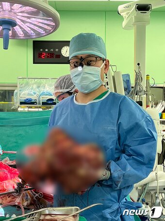 본문 이미지 - 이재근 교수가 수술 당시 환자에게서 제거한 간을 들고 있다.(세브란스병원 제공)