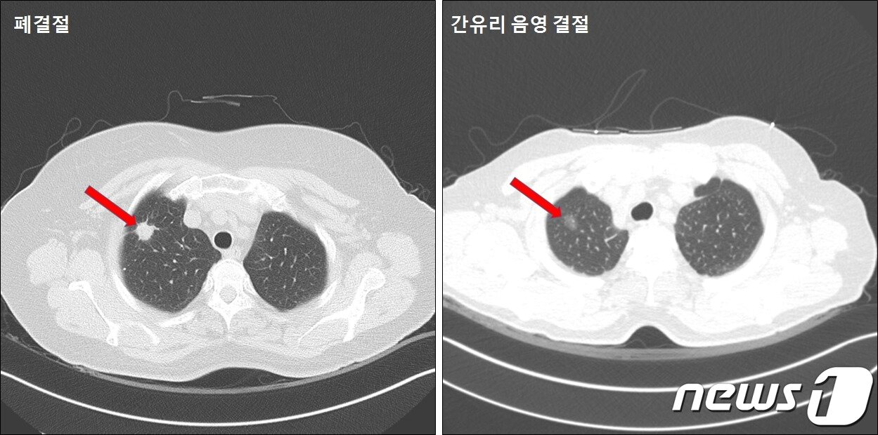 본문 이미지 - (은평성모병원 제공)