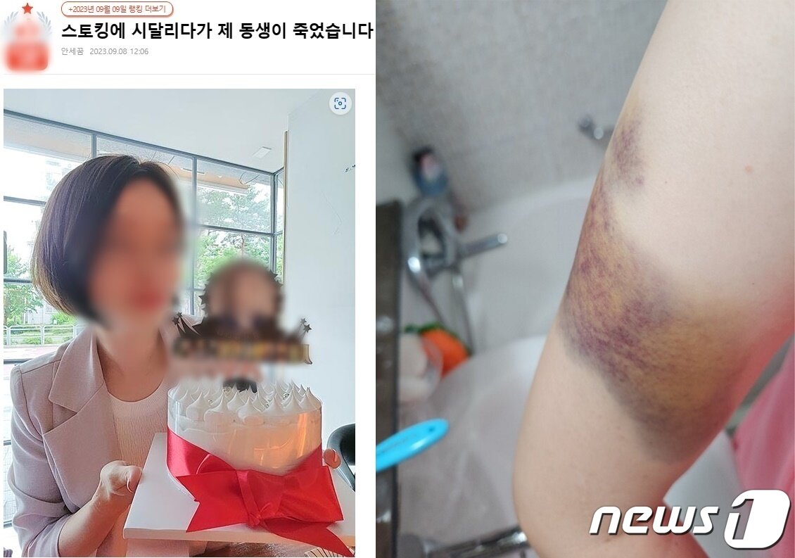 본문 이미지 - 전 남자친구에게 스토킹 피해를 겪다가 스마트워치 반납 나흘만에 살해당한 피해 여성. 사진은 여성의 동생이 인터넷 커뮤니티에 가해자에 대한 엄벌을 촉구하면서 올린 여성의 사진과 가해자로부터 (언니가)폭행 피해를 당한 모습을 남긴 사진(인터넷 커뮤니티 캡처)2023.9.18/뉴스1 ⓒ News1 박아론 기자