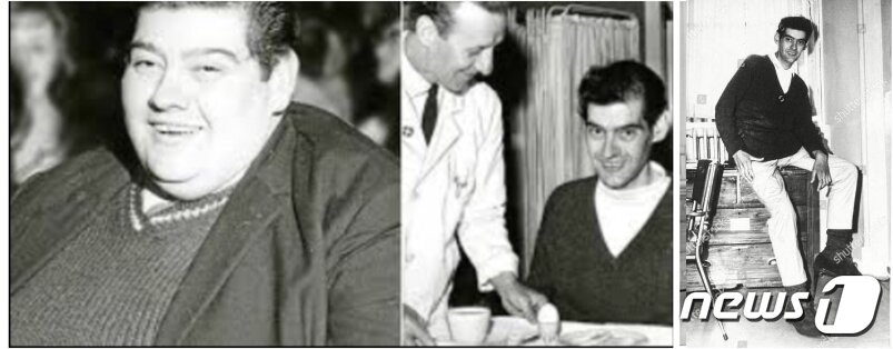 본문 이미지 - 1966년 6월, 33살 먹은 영국 스코틀랜드의 앵거스 바비에리가 207㎏에 초고도 비만을 해결하기 위해 의료진의 철저한 지도아래 무려 292일간 단식,  125㎏을 감량해 완전히 다른 사람으로 재탄생했다. ⓒ 뉴스1 DB