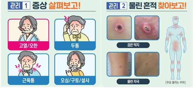 본문 이미지 - 진드기 매개 감염병 발생 시 나타나는 증상과 물린 흔적. (질병청 제공)