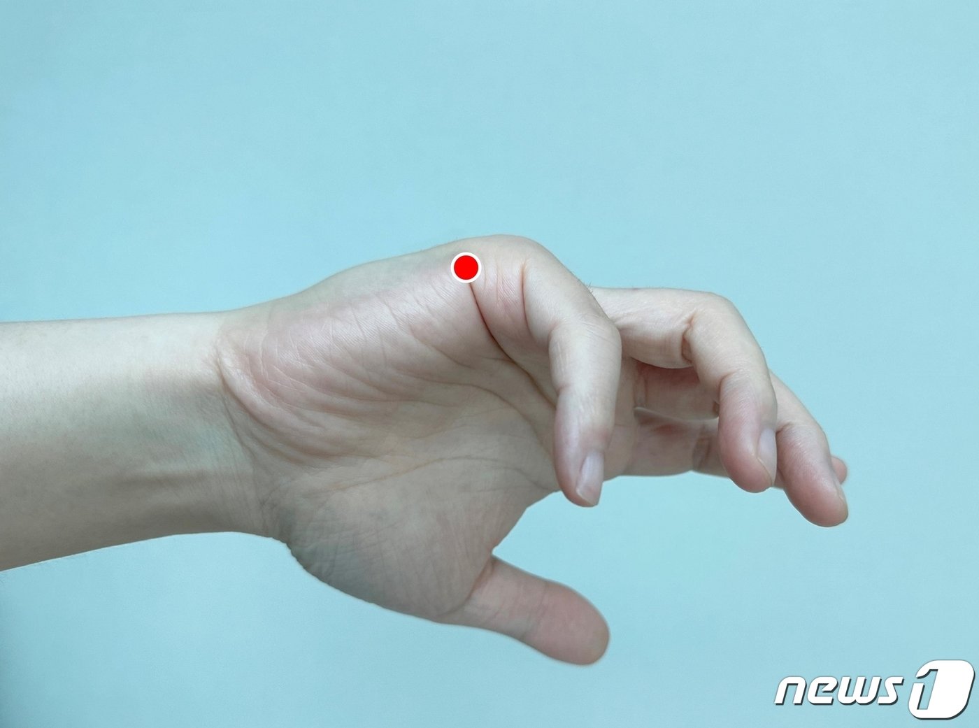 본문 이미지 - 후계혈(後谿穴). (대전자생한방병원 제공) /뉴스1