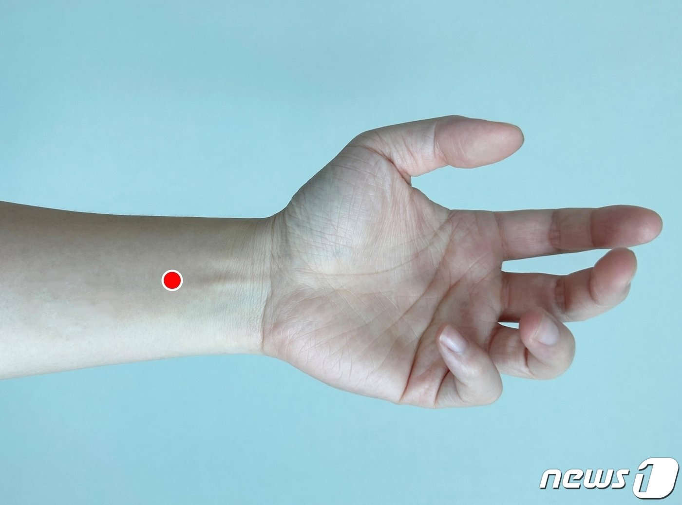 본문 이미지 - 내관혈(內關穴). (대전자생한방병원 제공) /뉴스1