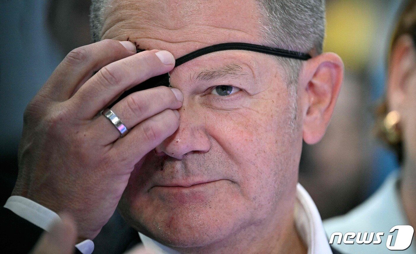 본문 이미지 - 안대를 만지고 있는 숄츠 총리. 2023.9.6 ⓒ AFP=뉴스1 ⓒ News1 우동명 기자