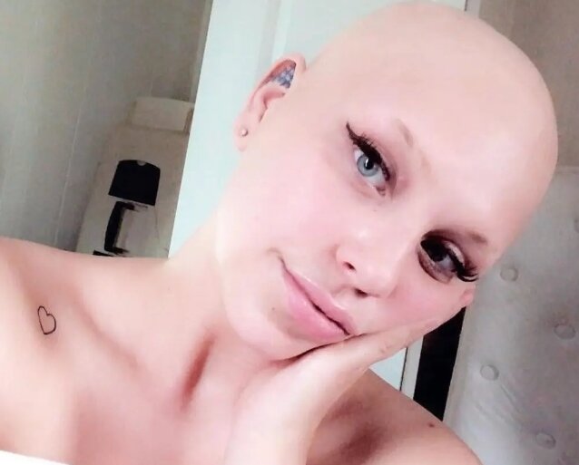 본문 이미지 - 탈모로 힘들어하는 연인을 위해 4년간 기른 자신의 머리를 가발로 만들어 선물한 한 남성의 사연이 감동을 안기고 있다. 뉴욕포스트 갈무리