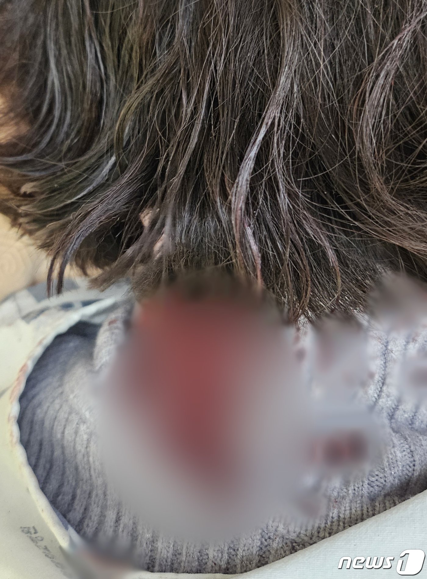 본문 이미지 - 지난 25일 배현진 국민의힘 의원 피습 직후 촬영된 사진. 회색 니트의 목주변에 다량의 혈흔이 묻어 있다. (배현진 의원실 제공) 2024.1.26/뉴스1 ⓒ News1 송원영 기자