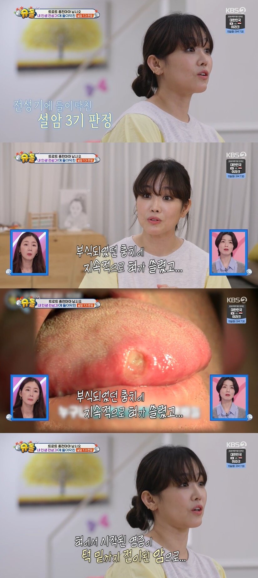 본문 이미지 - (KBS 2TV '슈퍼맨이 돌아왔다' 갈무리)