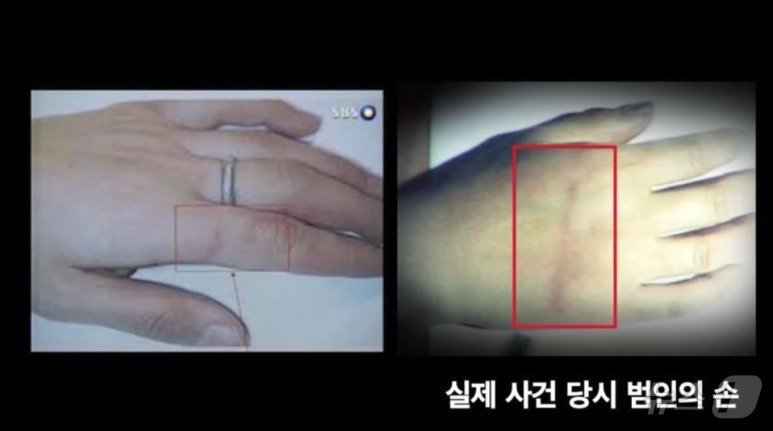 본문 이미지 - 범인 이 시의 왼손등에 난 밧줄자국. (SBS 갈무리) ⓒ 뉴스1