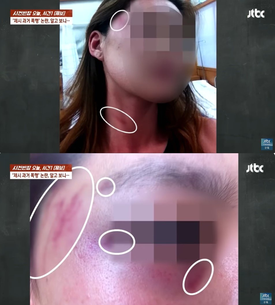 본문 이미지 - (JTBC '사건반장' 갈무리)
