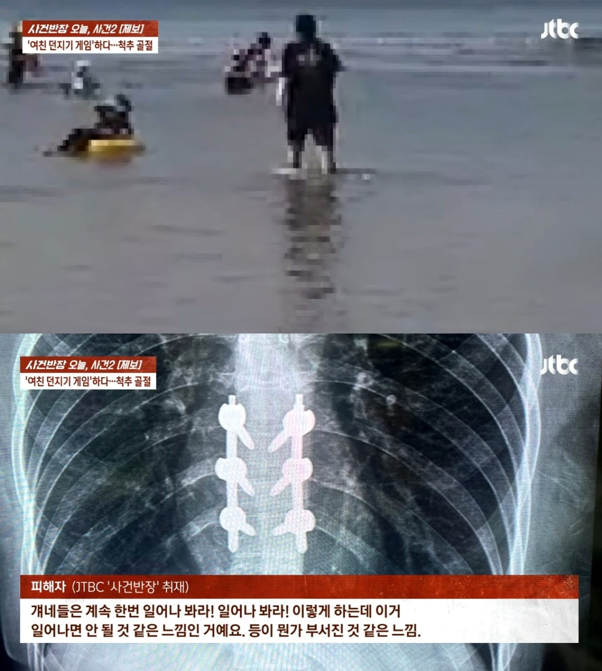 본문 이미지 - A 씨가 빠진 위치의 수심(위), A 씨의 엑스레이 사진. (JTBC '사건반장' 갈무리)