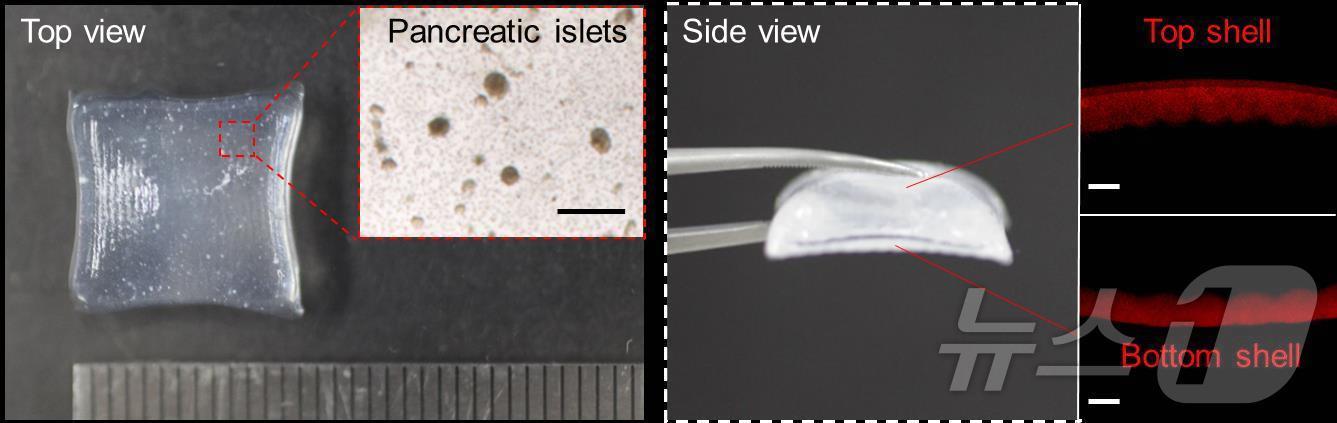 3D 프린팅 췌도 이식체의 이미지. &#40;UNIST 제공&#41;