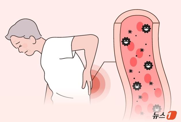 [100세건강] 10년 새 환자 2배…'다발골수종' 치료는 어떻게