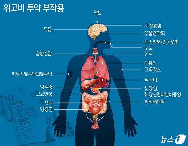 급성 췌장염·소장절제·사망까지…꿈의 비만약? 부작용 잇따라