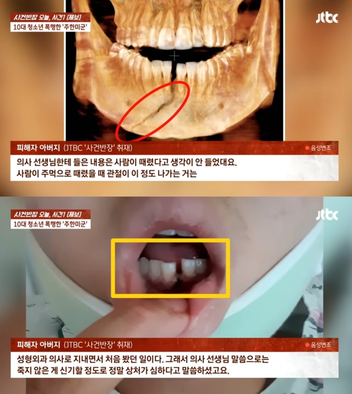 본문 이미지 - (JTBC '사건반장')