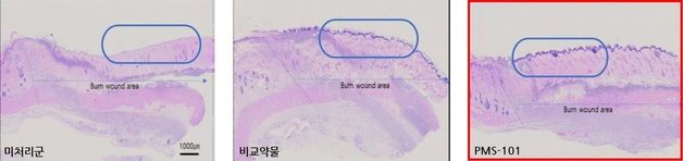 강스템바이오텍, 프리모리스테라퓨틱스 합병…엑소좀 시장 도전