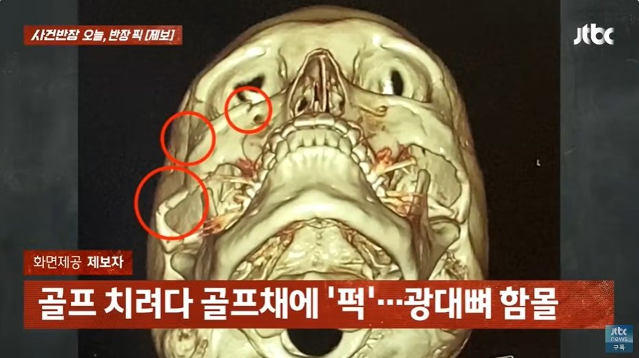 본문 이미지 - (JTBC '사건반장' 갈무리)