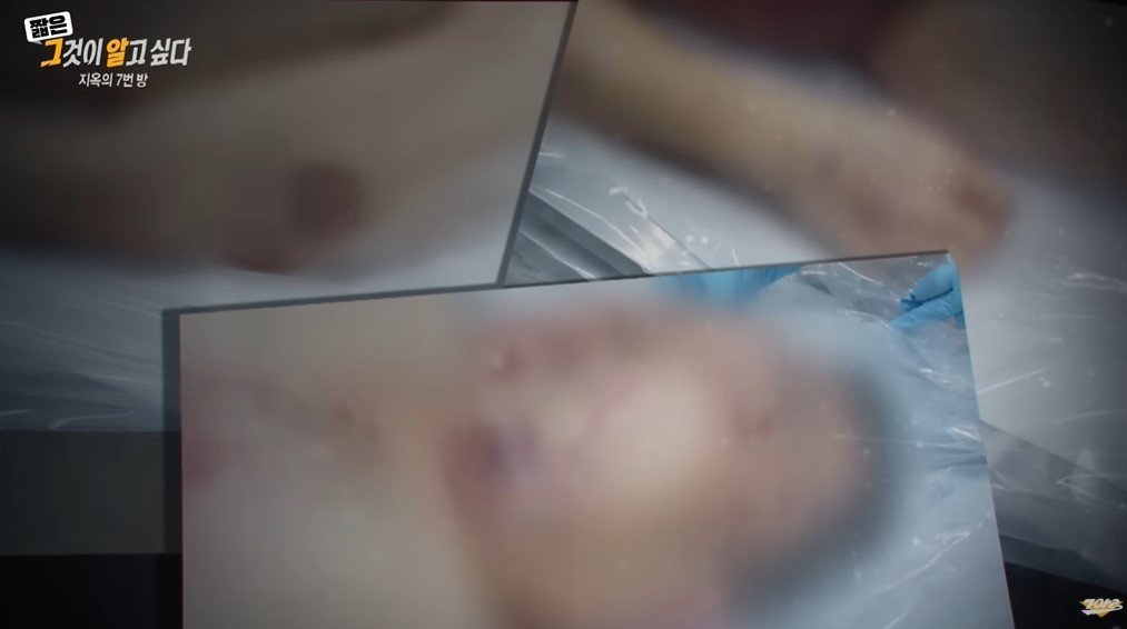 본문 이미지 - 박 씨의 온몸에 남은 멍 자국과 상처들. (SBS '그것이 알고 싶다')